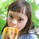 تغذیه کودکان سندرم داون