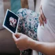 زمان شروع علائم بارداری