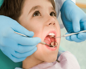 جلوگیری از پوسیدگی دندان شیری کودکان
