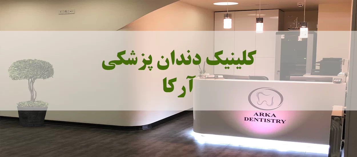بنر